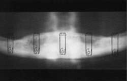 Implantologie Braunschweig - Röntgen-Messaufnahme Ausschnitt einer Röntgenaufnahme